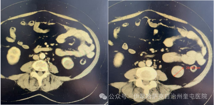 ef51330b2a5215d760bdc8ea440d1c6.png
